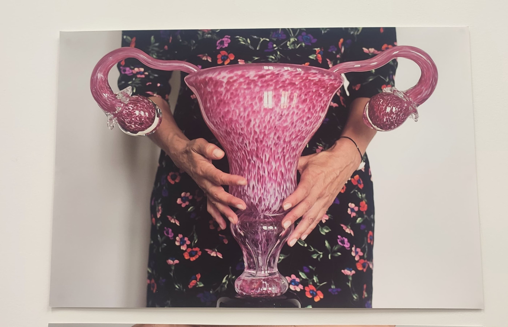© Cassandre Thomas. Le Vase de Freud, par Corinne Szabo. #ENDOs : un projet européen sur le thème de l'endométriose, mêlant art et santé