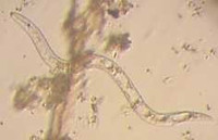 Les nématodes et santé des sols !