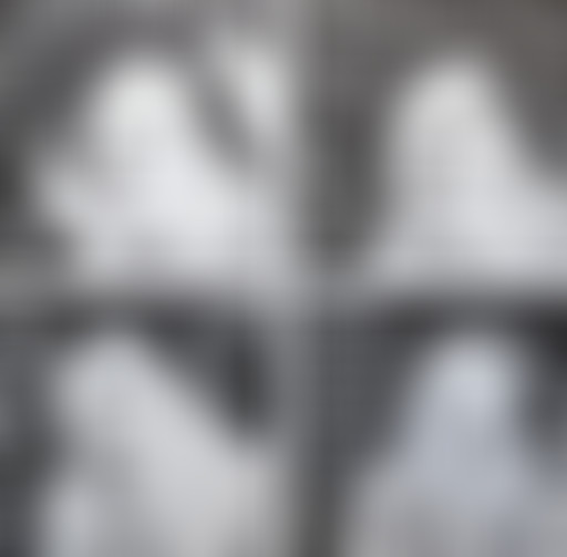 STUDIO ARTICHO 01 - KILLOFFER