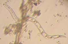 Nématode sur Wikimedia Commons Les nématodes et santé des sols !