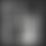 Yummy // Skank Bloc Records & Nouveautés