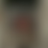 Amplitudes : Mode Balek⁴