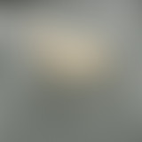 37°2 / Damien, le fer et le cheval