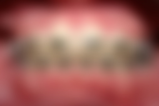 Chablis Hebdo // Évitez les appareils dentaires