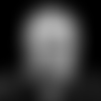 Le Néolibéralisme ou l'échec d'un entêtement sans...